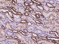 Invitrogen CRP2 Polyclonal Antibody 100 &mu;L; Unconjugated:Antibodies,