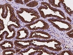 Invitrogen CYB561 Polyclonal Antibody 100 &mu;L; Unconjugated:Antibodies,
