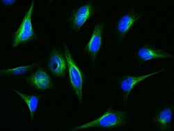 IFIT1 Polyclonal Antibody, Invitrogen 100 &mu;L; Unconjugated:Antibodies,