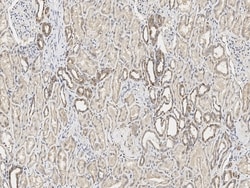 IFIT1 Polyclonal Antibody, Invitrogen 100 &mu;L; Unconjugated:Antibodies,