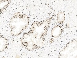 Invitrogen BRAF35 Polyclonal Antibody 100 &mu;L; Unconjugated:Antibodies,