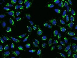 Invitrogen COX3 Polyclonal Antibody 100 &mu;L; Unconjugated:Antibodies,