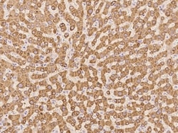 Invitrogen H6PD Polyclonal Antibody 100 &mu;L; Unconjugated:Antibodies,
