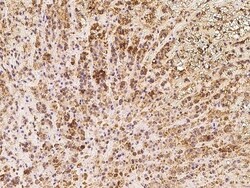Invitrogen TXNDC16 Polyclonal Antibody 100 &mu;L; Unconjugated:Antibodies,
