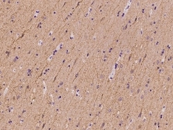 Invitrogen SLC4A10 Polyclonal Antibody 100 &mu;L; Unconjugated:Antibodies,