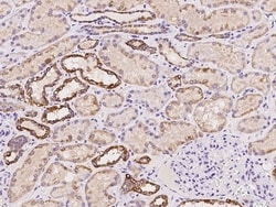 Invitrogen DREV Polyclonal Antibody 100 &mu;L | Buy Online | Invitrogen&trade; | Fisher Scientific