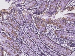 Invitrogen SLC35A2 Polyclonal Antibody 100 &mu;L; Unconjugated:Antibodies,