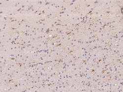 Invitrogen TRIM64C Polyclonal Antibody 100 &mu;L | Buy Online | Invitrogen&trade; | Fisher Scientific