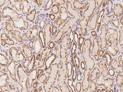 Invitrogen DNAH8 Polyclonal Antibody 100 &mu;L; Unconjugated:Antibodies,