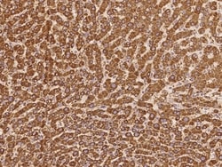 Invitrogen DNAH8 Polyclonal Antibody 100 &mu;L; Unconjugated:Antibodies,