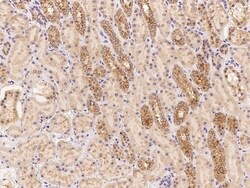 Invitrogen LMBRD2 Polyclonal Antibody 100 &mu;L; Unconjugated:Antibodies,
