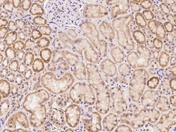 Invitrogen TLCD1 Polyclonal Antibody 100 &mu;L | Buy Online | Invitrogen&trade; | Fisher Scientific
