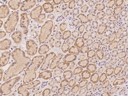 Invitrogen HRASLS Polyclonal Antibody 100 &mu;L; Unconjugated:Antibodies,