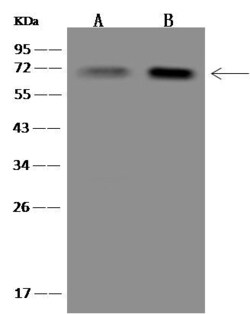 Invitrogen KBTBD12 Polyclonal Antibody 100 &mu;L; Unconjugated:Antibodies,
