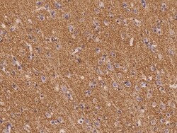 Invitrogen SV2B Polyclonal Antibody 100 &mu;L | Buy Online | Invitrogen&trade; | Fisher Scientific