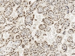 Invitrogen TBX3 Polyclonal Antibody 100 &mu;L | Buy Online | Invitrogen&trade; | Fisher Scientific