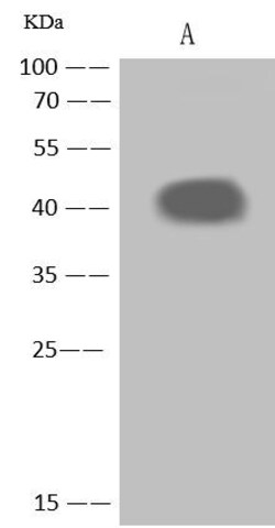 Invitrogen NEGR1 Polyclonal Antibody 100 &mu;L; Unconjugated:Antibodies,