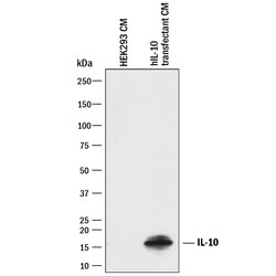 Invitrogen IL-10 Polyclonal Antibody 1 mg; Unconjugated:Antibodies, Polyclonal