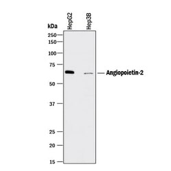 Invitrogen Angiopoietin 2 Polyclonal Antibody 1 mg; Unconjugated:Antibodies,