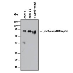 Invitrogen LTBR Polyclonal Antibody 100 &mu;g; Unconjugated:Antibodies,