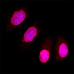 Invitrogen PPM1D Polyclonal Antibody 100 &mu;g; Unconjugated:Antibodies,