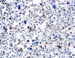 Invitrogen BMP-8 Polyclonal Antibody 100 &mu;g | Buy Online | Invitrogen&trade; | Fisher Scientific