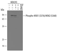 Invitrogen Phospho-MSK1/MSK2 (Ser376/Ser360) Polyclonal Antibody 100 &mu;g | Buy Online | Invitrogen&trade; | Fisher Scientific