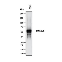 Invitrogen Thymidine Phosphorylase Polyclonal Antibody 100 &mu;g; Unconjugated:Antibodies,