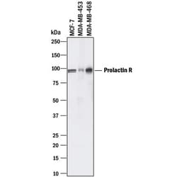 Invitrogen Prolactin Receptor Polyclonal Antibody 100 &mu;g; Unconjugated:Antibodies,