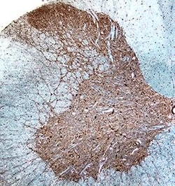 Invitrogen GABBR2 Polyclonal Antibody 100 &mu;g; Unconjugated:Antibodies,