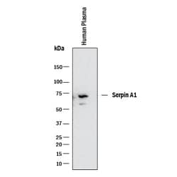 Invitrogen alpha-1 Antitrypsin Polyclonal Antibody 100 &mu;g; Unconjugated:Antibodies,