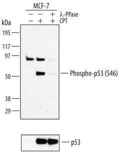 Invitrogen Phospho-p53 (Ser46) Polyclonal Antibody 100 &mu;g; Unconjugated:Antibodies,