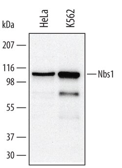 Invitrogen NBS1 Polyclonal Antibody 100 &mu;g; Unconjugated:Antibodies,