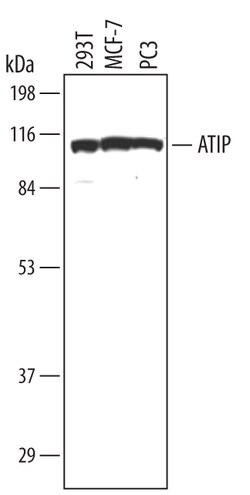 Invitrogen ATRIP Polyclonal Antibody 100 &mu;g; Unconjugated:Anticorps,