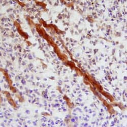 Invitrogen&trade;&nbsp;IHH Polyclonal Antibody