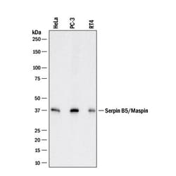 Invitrogen Maspin Polyclonal Antibody 100 &mu;g; Unconjugated:Antikörper