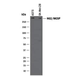 Invitrogen NG2 Polyclonal Antibody 100 &mu;g | Buy Online | Invitrogen&trade; | Fisher Scientific