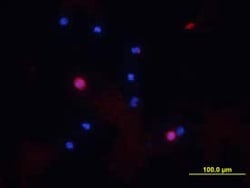 Invitrogen CD8a Polyclonal Antibody 100 &mu;g; Unconjugated:Antibodies,