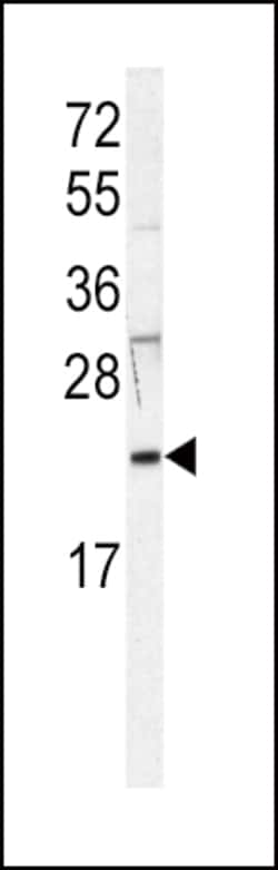 Invitrogen H-Ras Polyclonal Antibody 400 &mu;L; Unconjugated:Antibodies,