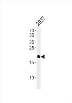 Invitrogen H-Ras Polyclonal Antibody 400 &mu;L; Unconjugated:Antibodies,