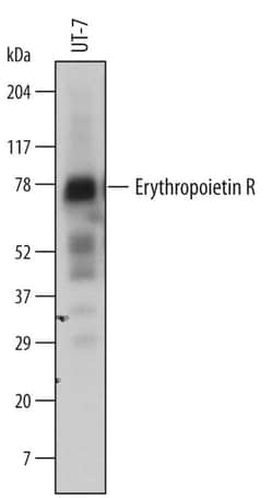 Invitrogen EpoR Polyclonal Antibody 100 &mu;g; Unconjugated:Antibodies,