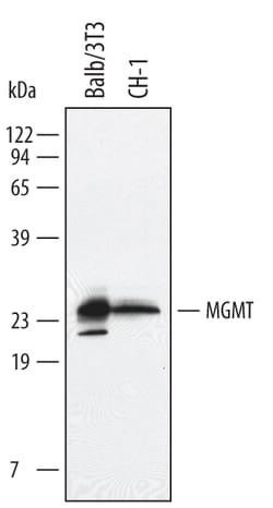Invitrogen MGMT Polyclonal Antibody 100 &mu;g; Unconjugated:Antibodies,