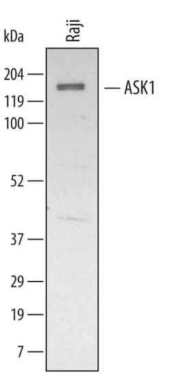 Invitrogen ASK1 Polyclonal Antibody 100 &mu;g | Buy Online | Invitrogen&trade; | Fisher Scientific