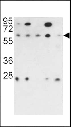 Invitrogen PPP2R3B Polyclonal Antibody 400 &mu;L; Unconjugated:Antibodies,