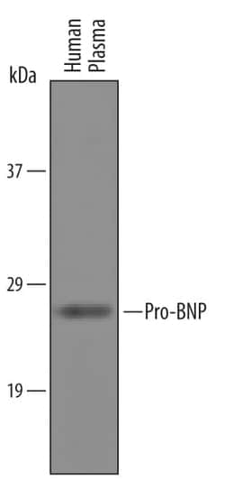 Invitrogen pro-Brain Natriuretic Peptide Polyclonal Antibody 100 &mu;g;