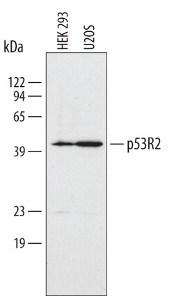 Invitrogen p53R2 Polyclonal Antibody 100 &mu;g; Unconjugated:Antibodies,