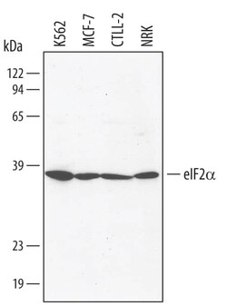 Invitrogen EIF2S1 Polyclonal Antibody 100 &mu;g; Unconjugated:Antibodies,