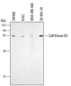 Invitrogen CaMKII delta Polyclonal Antibody 100 &mu;g; Unconjugated:Antibodies,