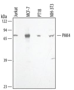 Invitrogen PAK4 Polyclonal Antibody 100 &mu;g; Unconjugated:Antikörper