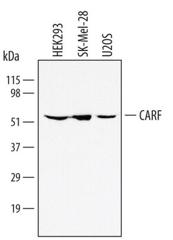 Invitrogen CARF Polyclonal Antibody 100 &mu;g; Unconjugated:Antibodies,
